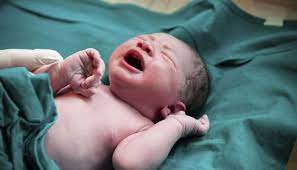குழந்தையின் வயிற்றில் காணப்பட்ட கட்டி....  மருத்துவர்கள்  அதிர்ச்சி